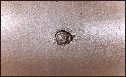 Entering the Corrosion World of Coiled Tubing（No.5）Corrosion by Microorganisms